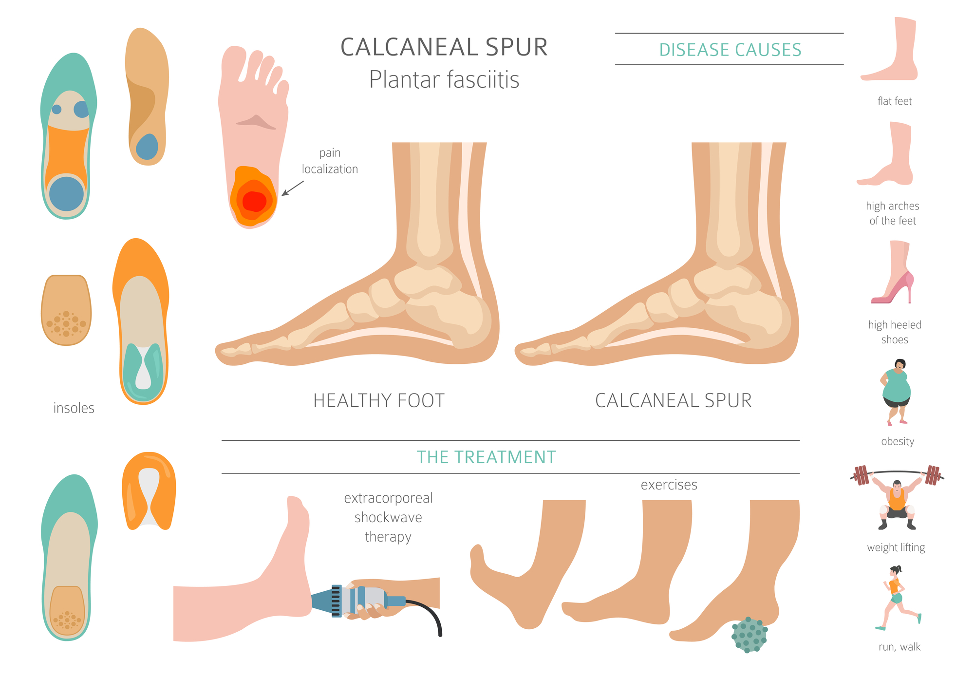 HEEL PAIN - Causes, Treatment, and Prevention | K P Meda