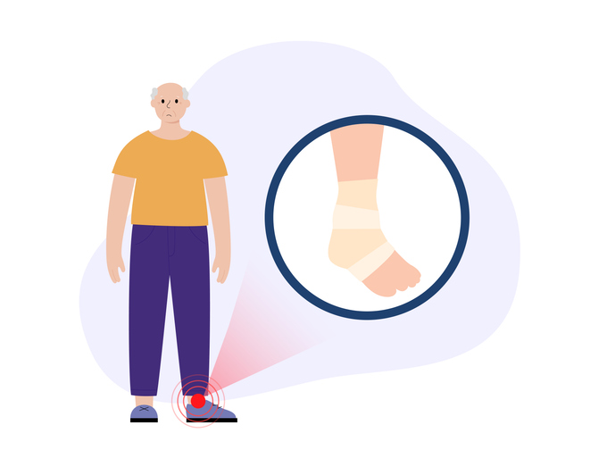 Sore, cut or ulker on human leg. Elastic bandage, wrap medical gauze over foot. First help for old age man with injured ankle in a clinic or hospital. Patient with trauma flat vector illustration